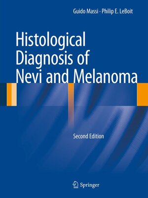 cover image of Histological Diagnosis of Nevi and Melanoma